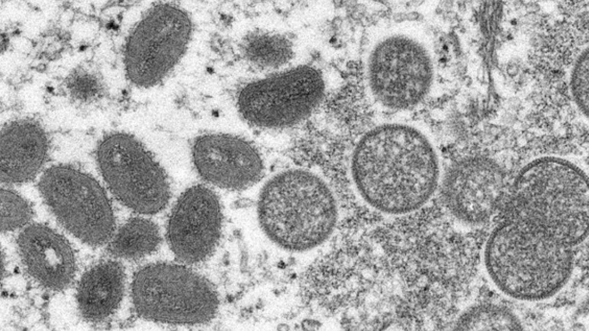 Varíola dos macacos: cientistas debatem sobre transmissão aérea do vírus - Getty Images