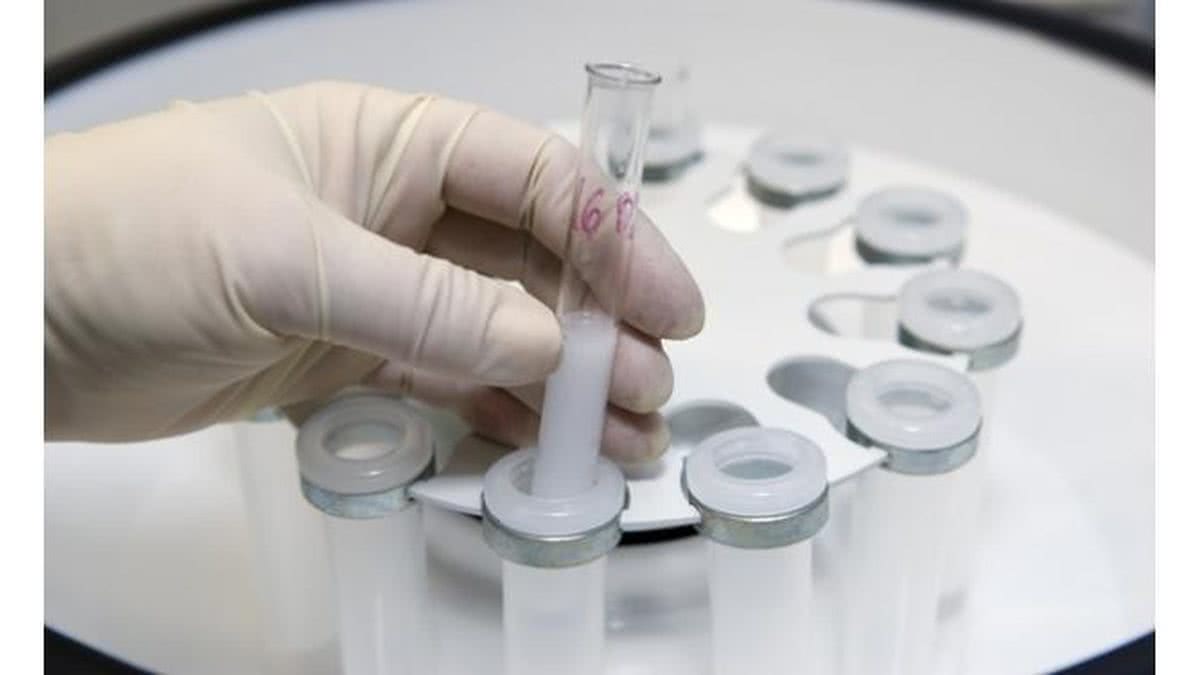 Imagem Cientistas dizem ter criado espermatozoide in vitro