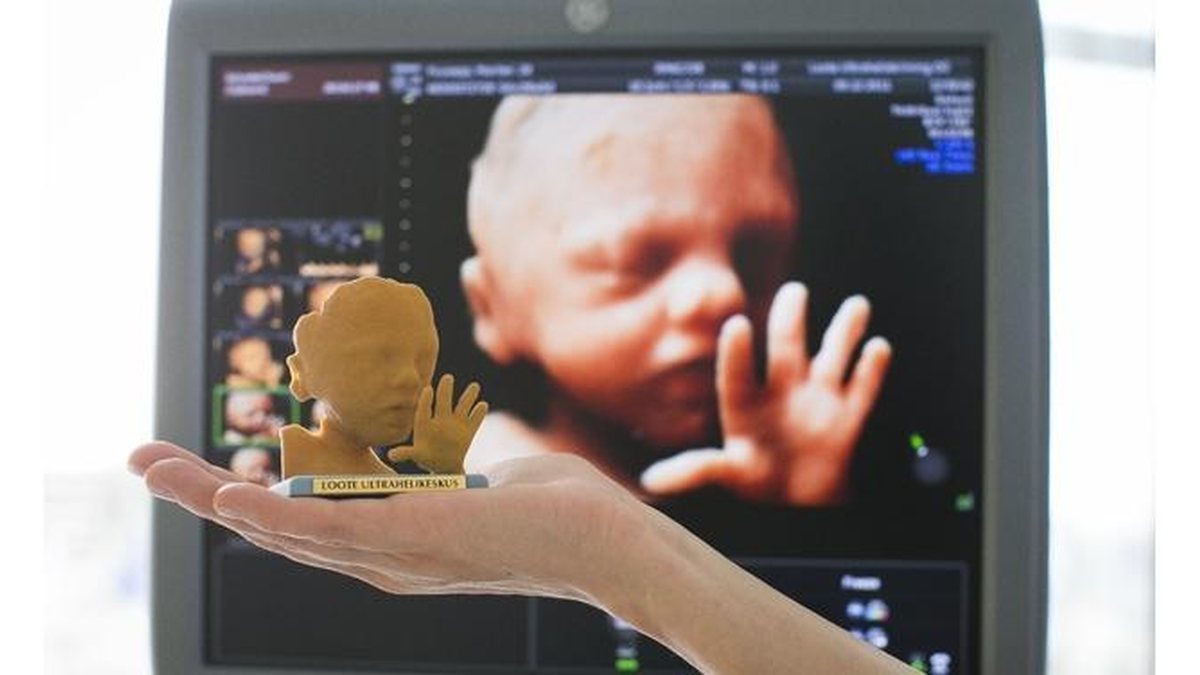 Imagem Impressora 3D replica imagem de bebê na barriga