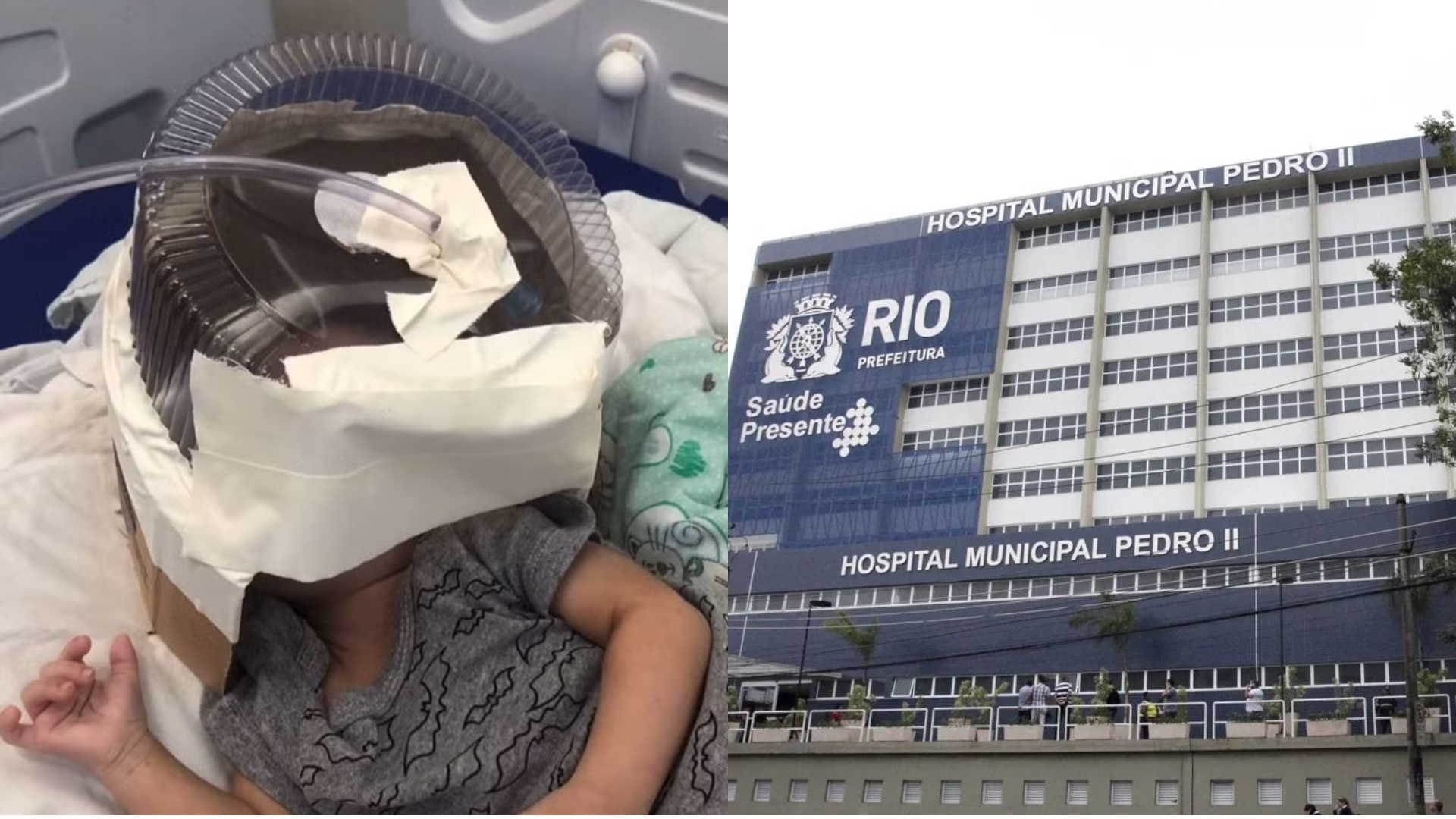 Bebê de três meses precisa usar máscara de oxigênio improvisada no RN