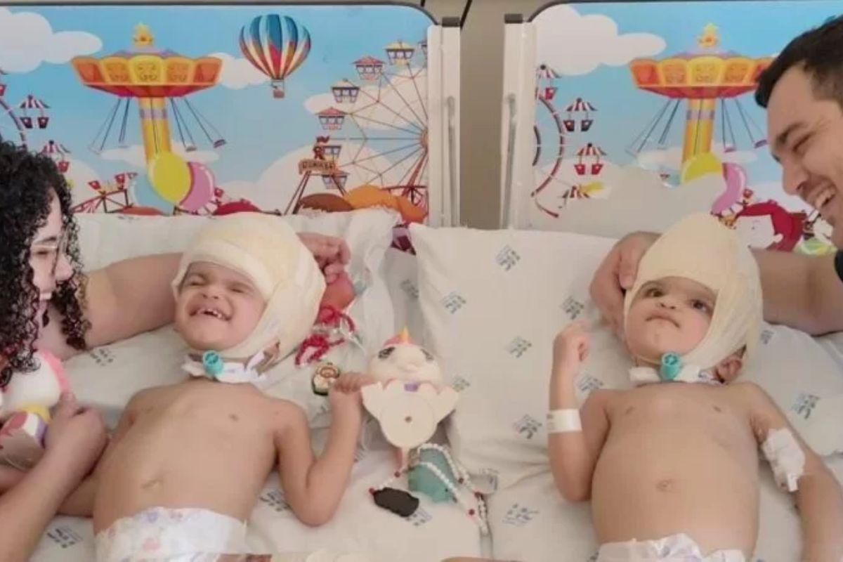 Allana e Mariah, gêmeas siamesas separadas por cirurgia, gêmeas que passaram por cirurgia de separação, Hospital das Clínicas da Faculdade de Medicina de Ribeirão Preto, HC Criança