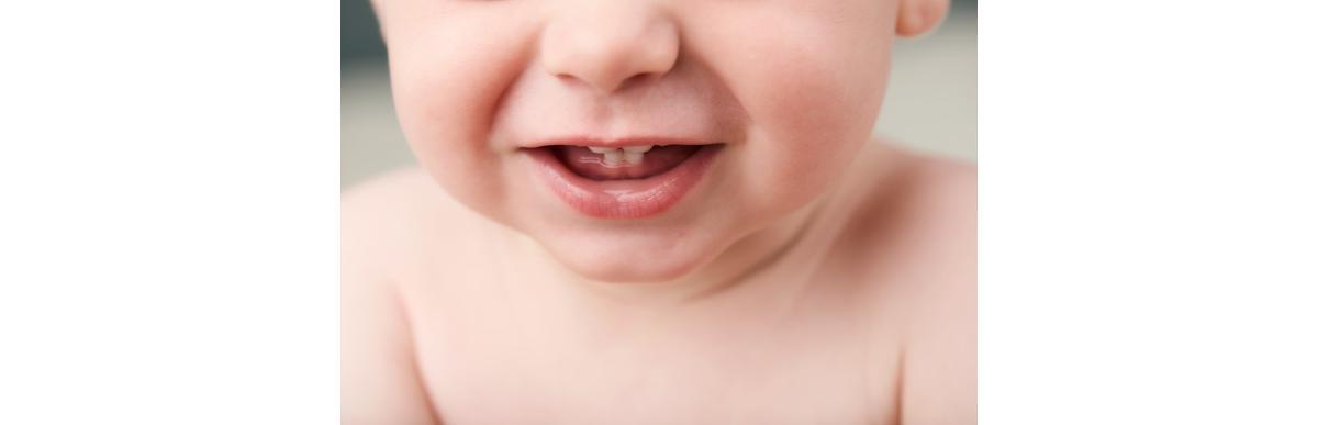 Sabia que alguns bebês já nascem com dentes?