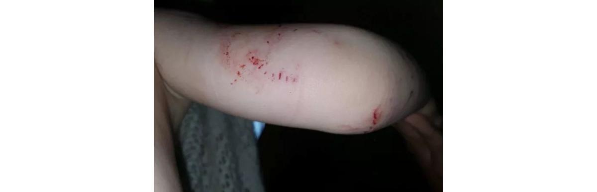 Menino atacado por cobra é salvo pelo avô