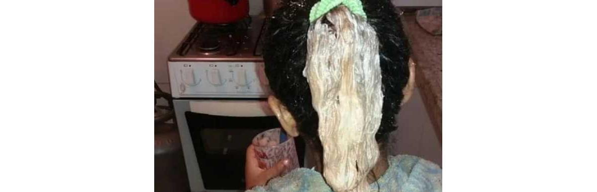 Madrasta da criança usou produtos químicos no cabelo da menina.