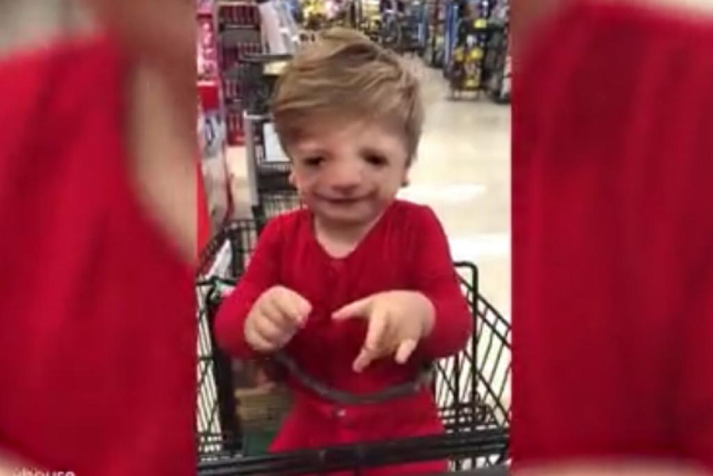 A Síndrome de Treacher Collins afeta os ossos do rosto