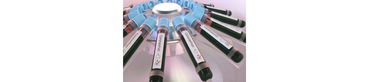 Novos estudos estão sendo realizados para ajudar no combate contra a Covid-19