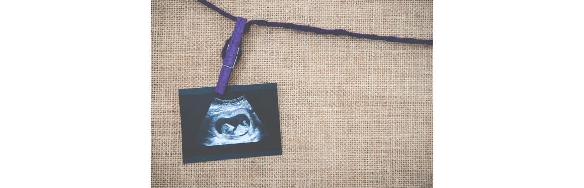 Mulher conta em fórum anônimo que sogro publicou notícia de seu aborto espontâneo nas redes sociais