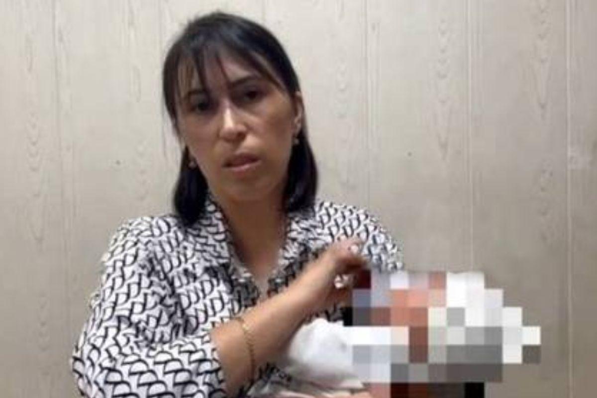 Mulher vende bebê para financiar cirurgia plástica no nariz