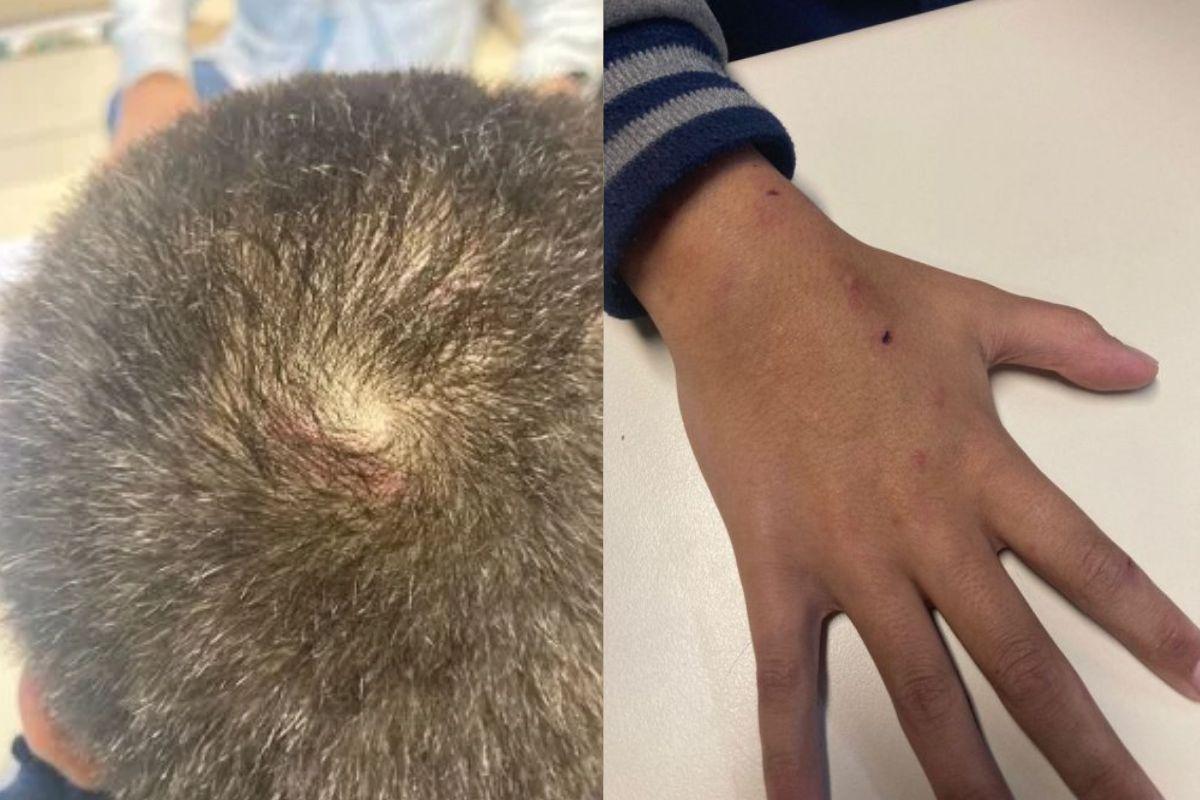 Momento em que o garoto chega para ir prestar sua denúncia