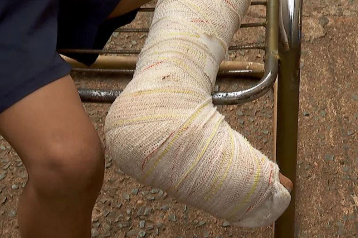 Criança tem ferimentos no pé e no rosto ao ser atropelado