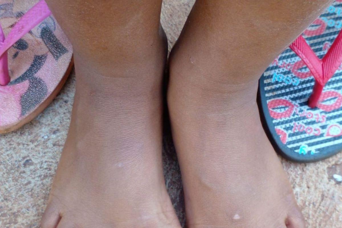 Pais tentam arrecadas dinheiro para fazer viagem em busca de um diagnóstico para o que a filha tem