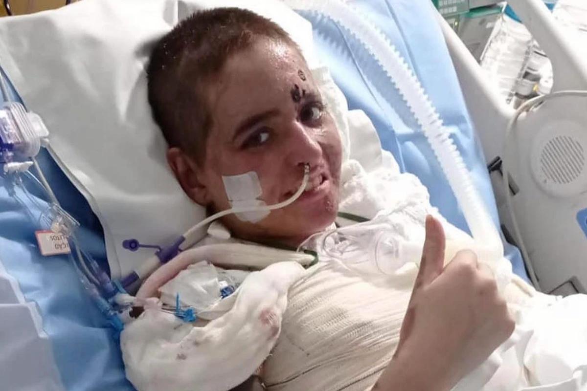 O casal, Duda e Lucas, foram atingidos quando o fogo imediato atingiu a vasilha por perto, que provocou uma explosão