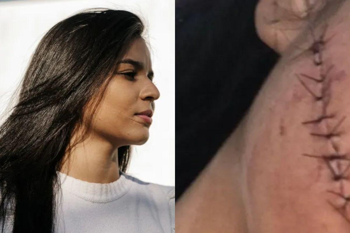 Stéfani teve o rosto cortado durante uma viagem no dia 29 de novembro