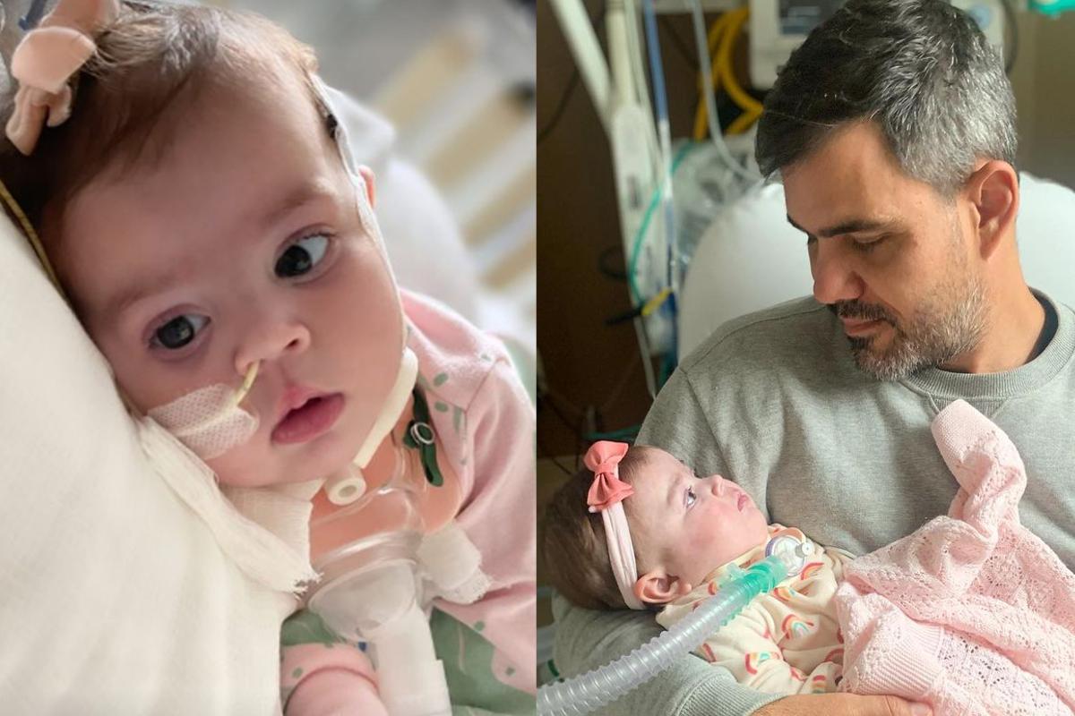 Maria Guilhermina, filha de Juliano Cazarré, passou por uma traqueostomia com poucos meses de vida