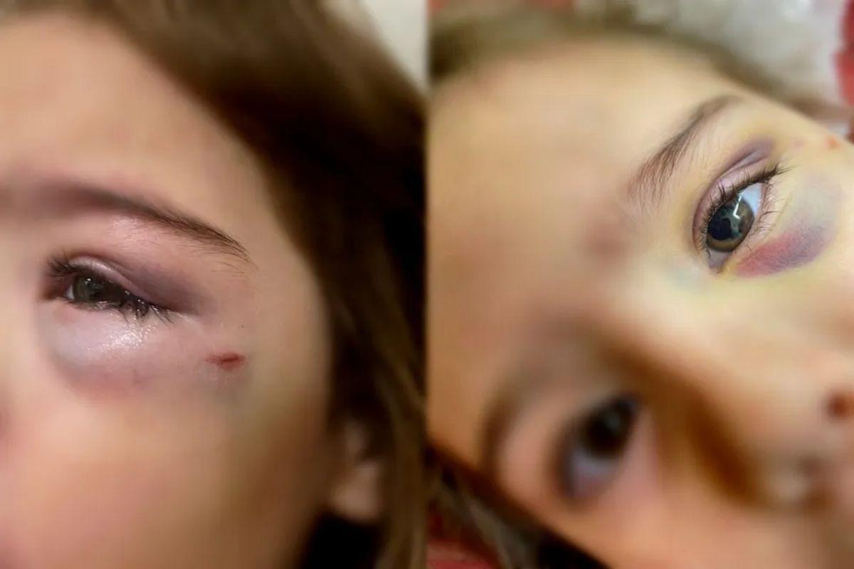 O caso revoltou a mãe