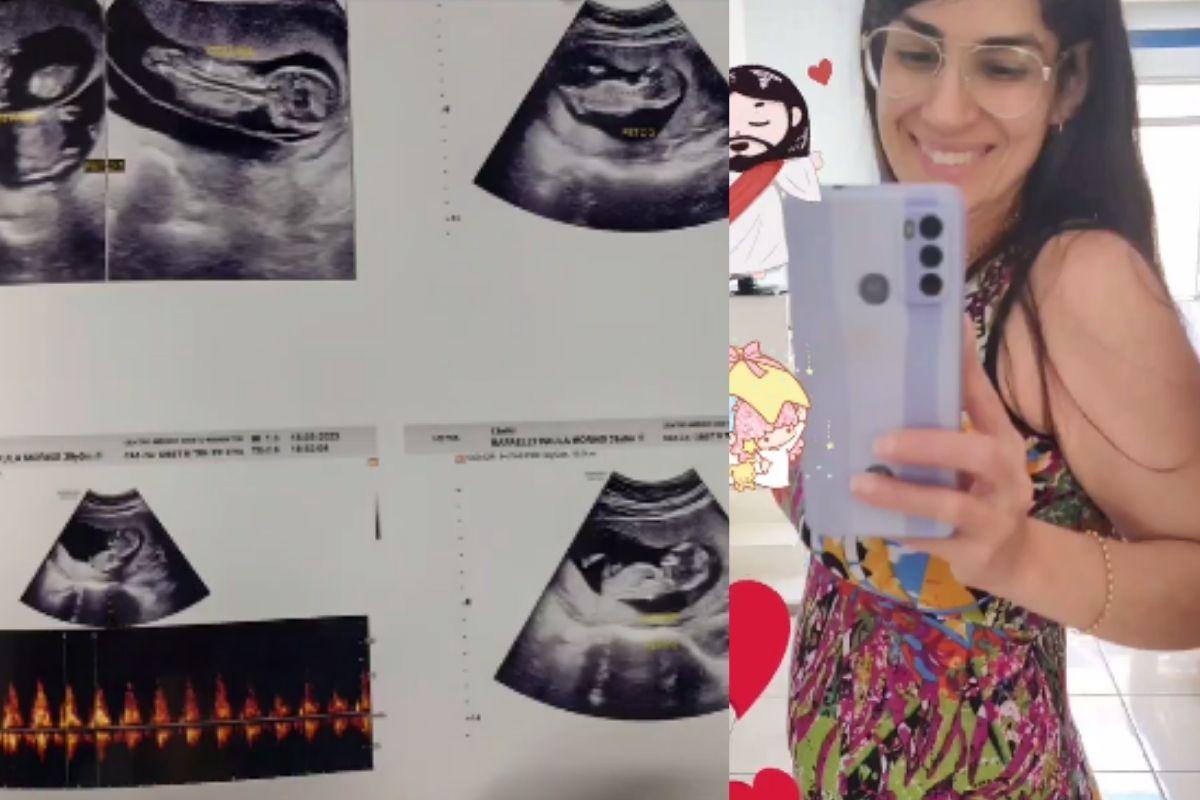 Mãe de quíntuplos relembra como soube que os filhos não resistiriam: “Imaginávamos tudo com eles”