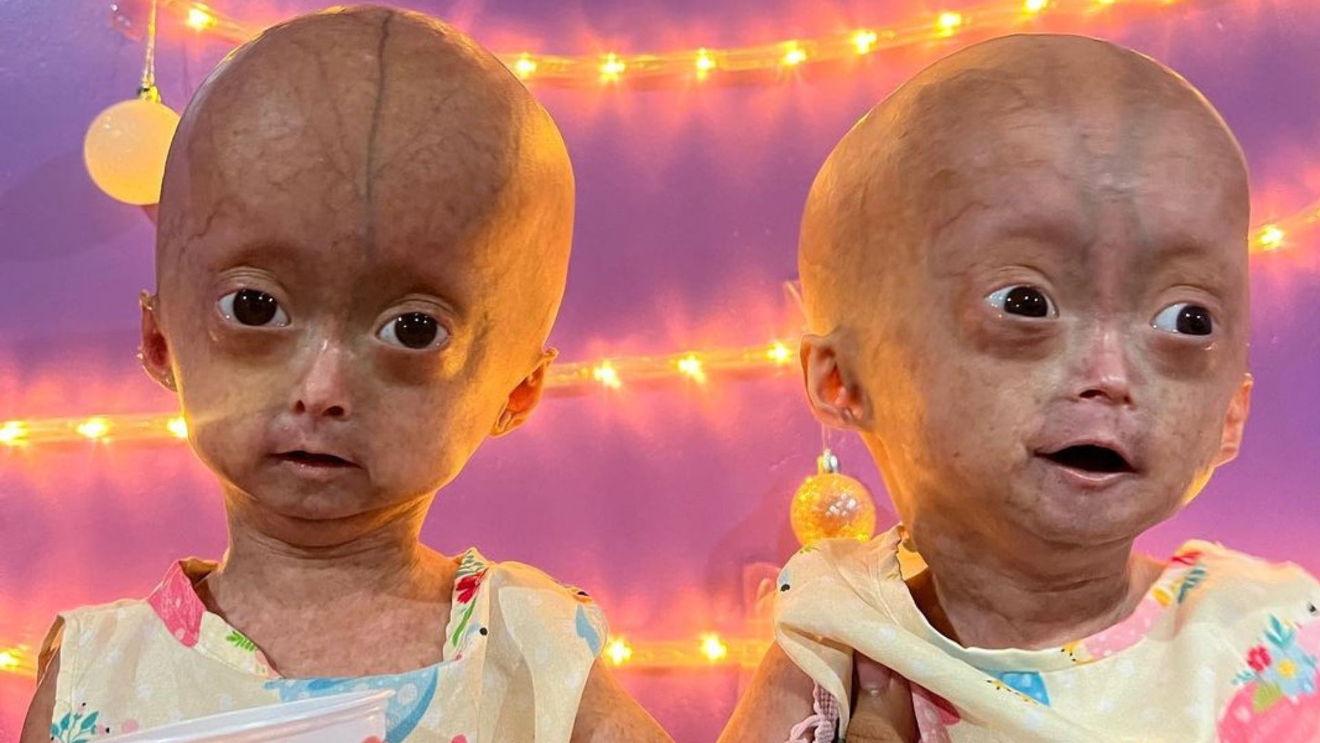 Elis e Eloá