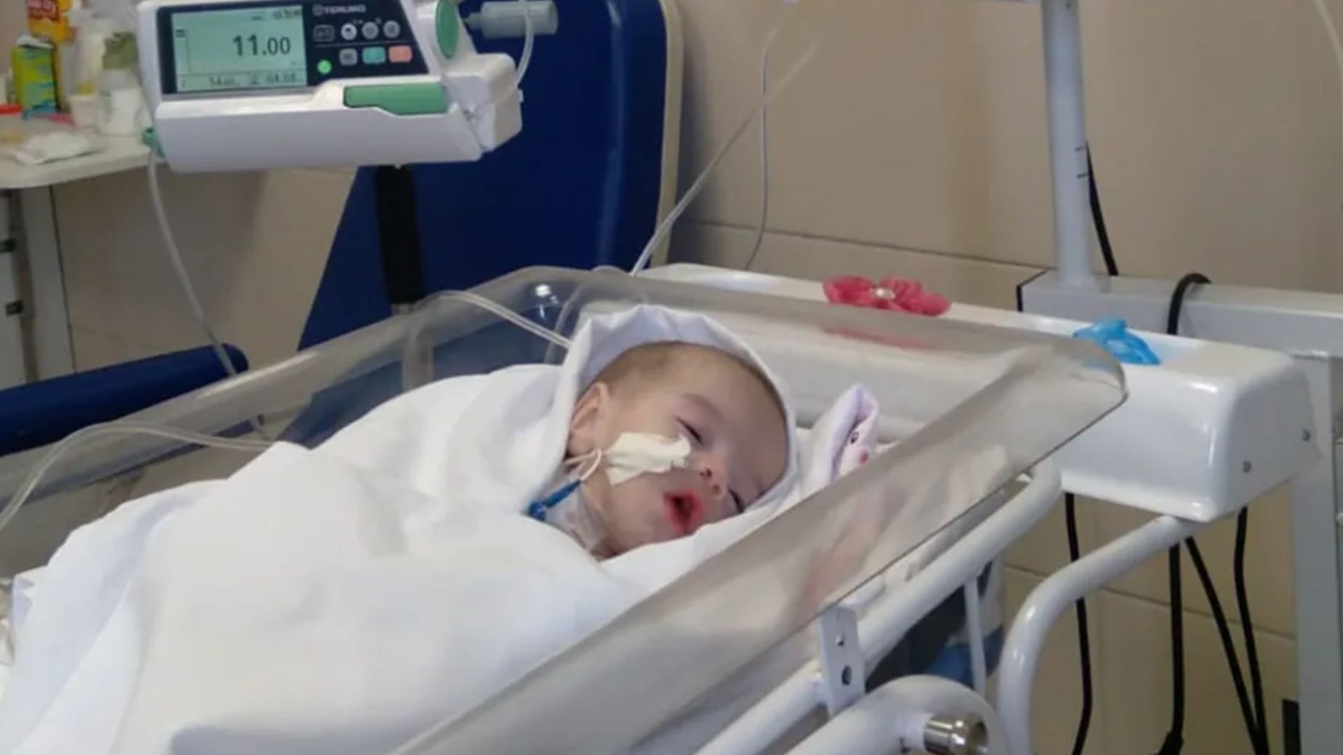 Após 3 anos no hospital, bebê que nasceu com intestino para fora do corpo recebe alta