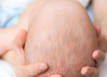 Moleira do bebê: o que é e como cuidar?