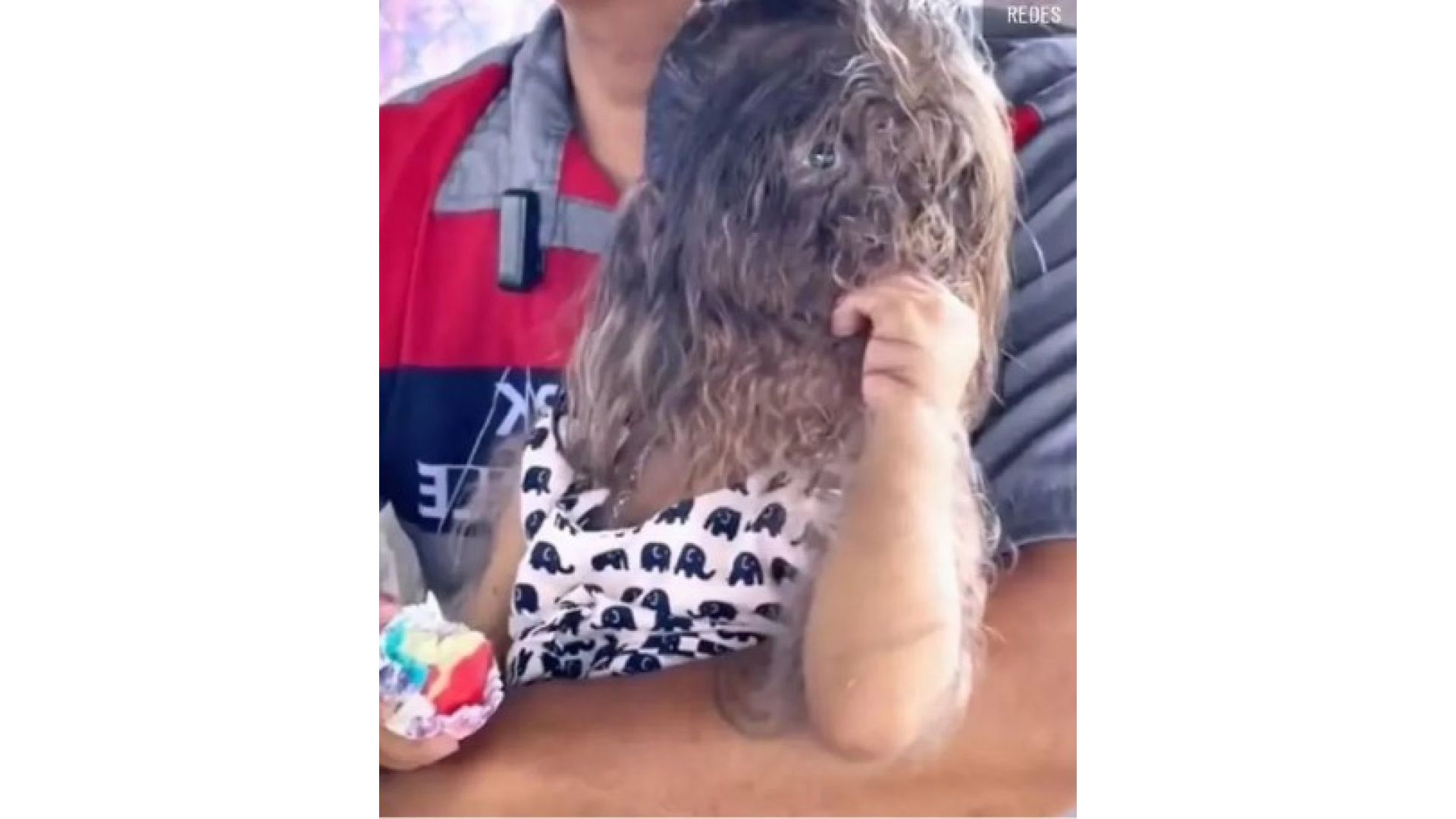 A menina nasceu com uma doença rara