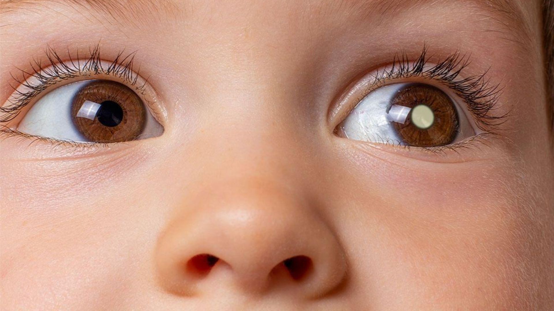 Olhos de criança