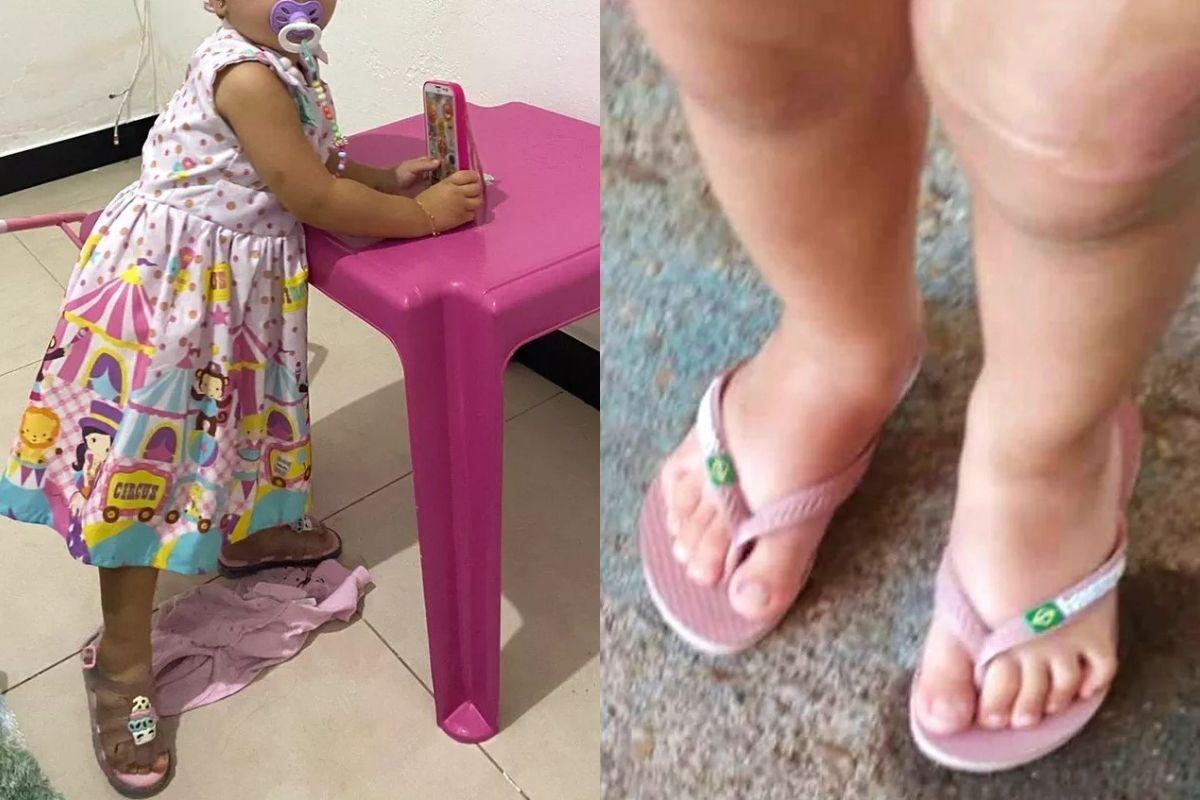 A bebê está se recuperando após passar por diversas cirurgias