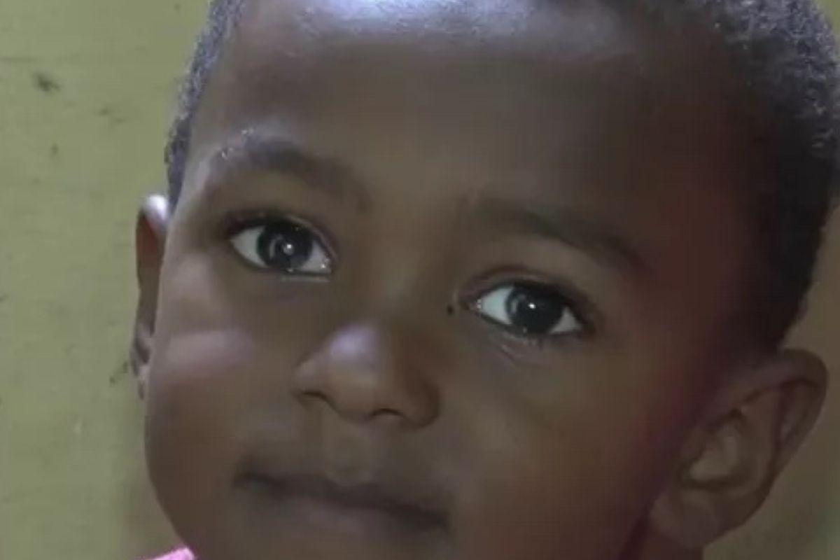 Feliphe tem 2 anos e ainda aguarda a retirada de pontos da cirurgia no olho (Foto: Reprodução /TV Santa Cruz)