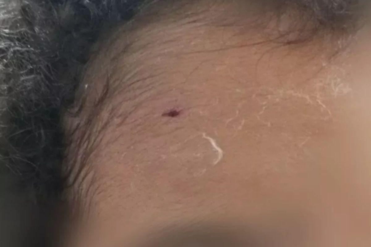 Mãe e filho são atacados por Pitbull dentro de petshop