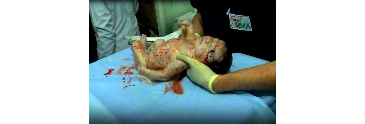 Bebê sobrevivente 1