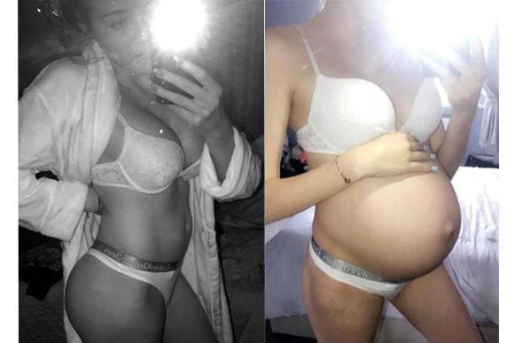 De uma hora para outra, ela ganhou uma barriga de 8 meses (Foto: Reprodução/ The Sun)