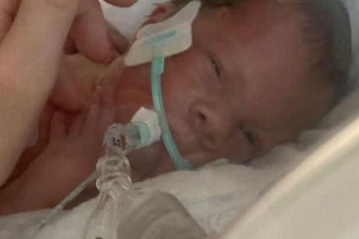 Mãe descobre que a condição rara no bebê após sofrer fortes dores nas costas durante a gravidez