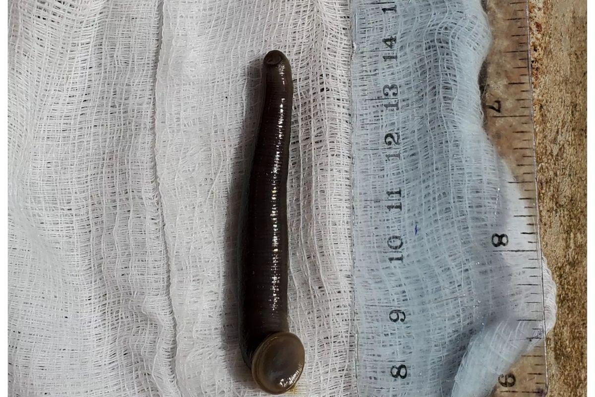 A sanguessuga impressionou o médico