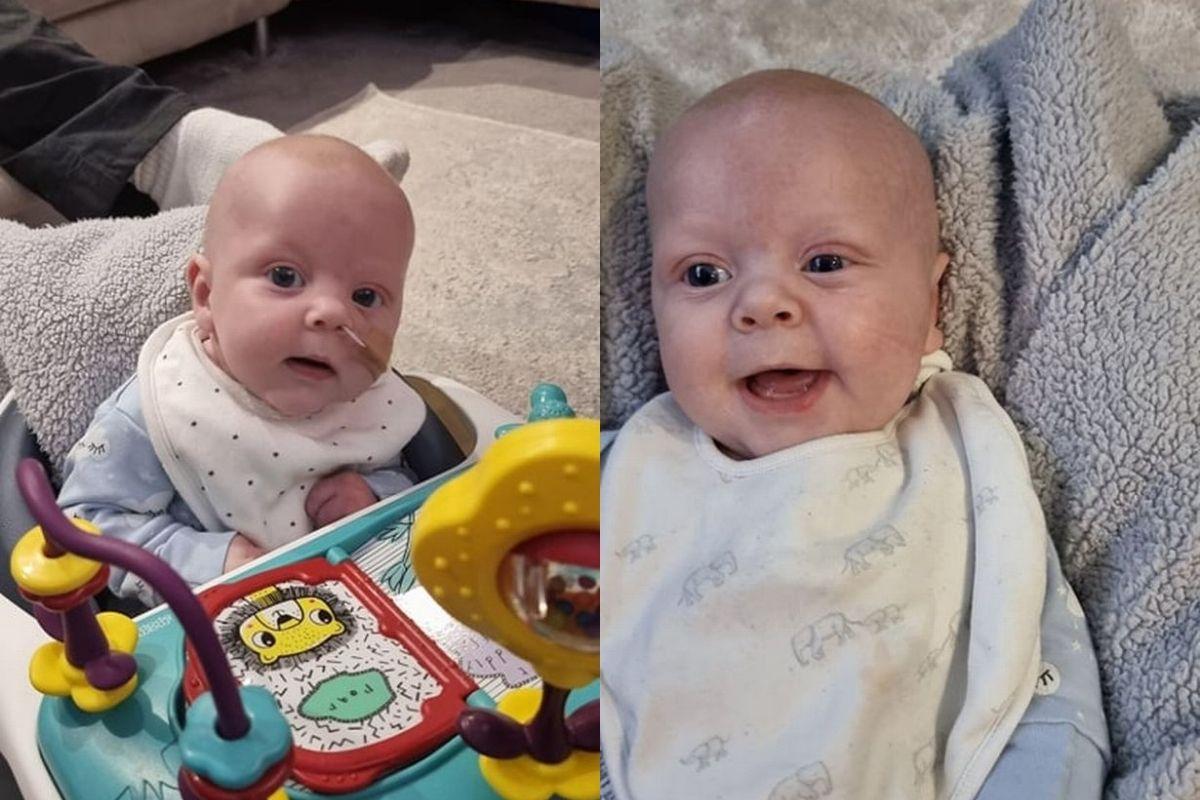 Cruz passou por duas cirurgias cardíacas com apenas 10 semanas de vida e sobreviveu