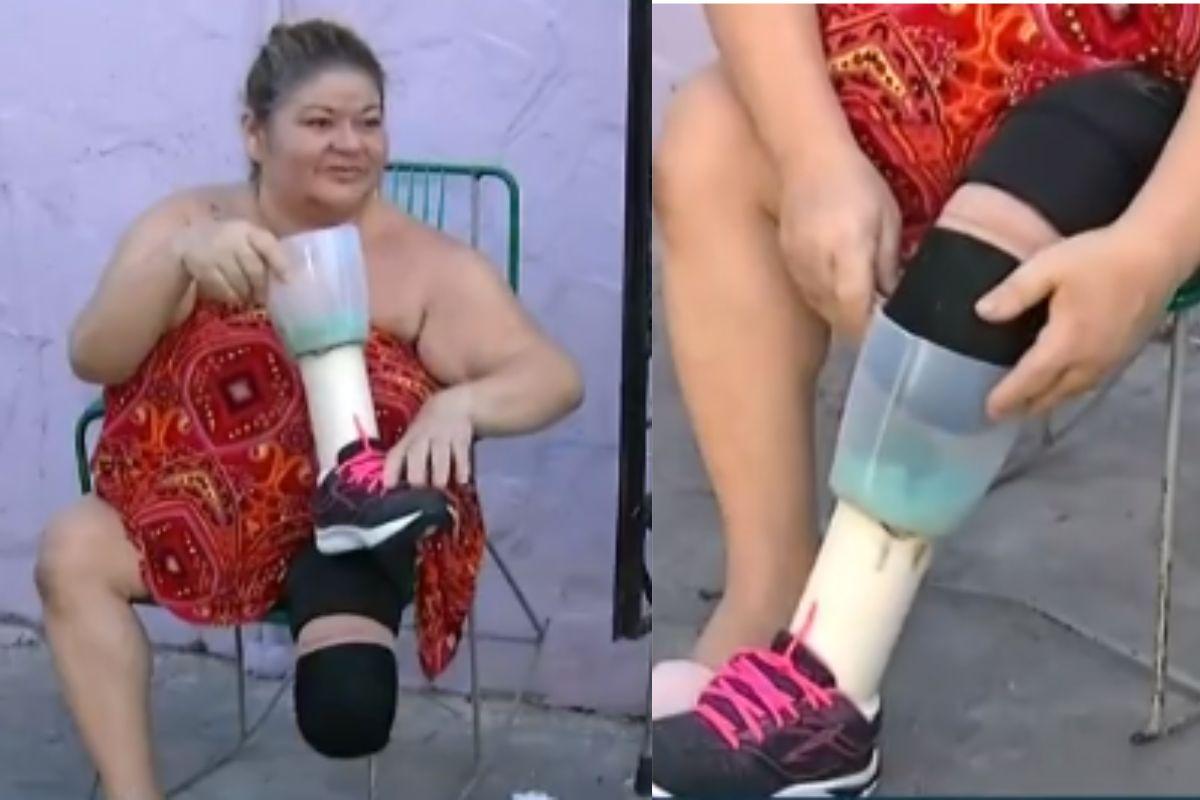 Mulher usa liquidificador como prótese