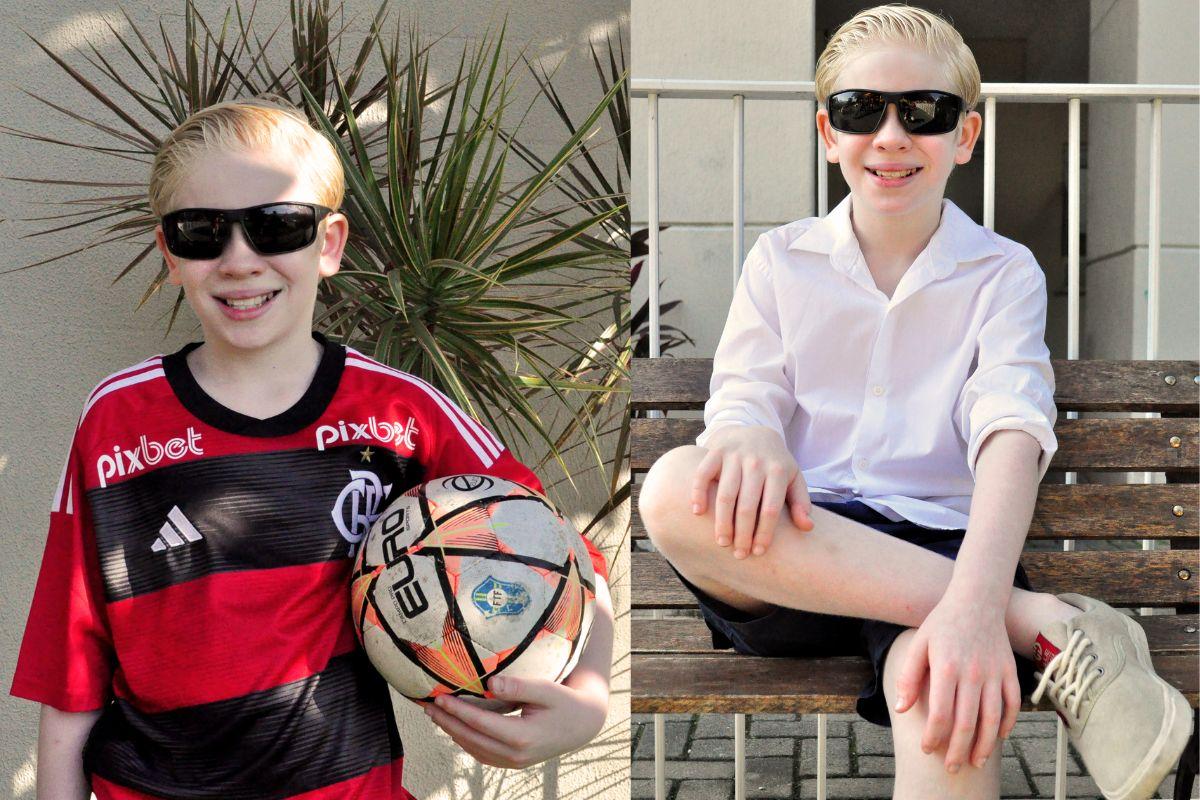 Felipe Melquiades, ator mirim Felipe Melquiades, família Felipe Melquiades, Felipe Melquiades albinismo, Cristian Terra e Paixão, Cristian novela albino, ator mirim albino