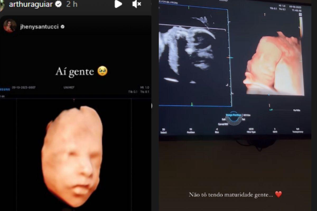 Ultrassom Jheny Santucci