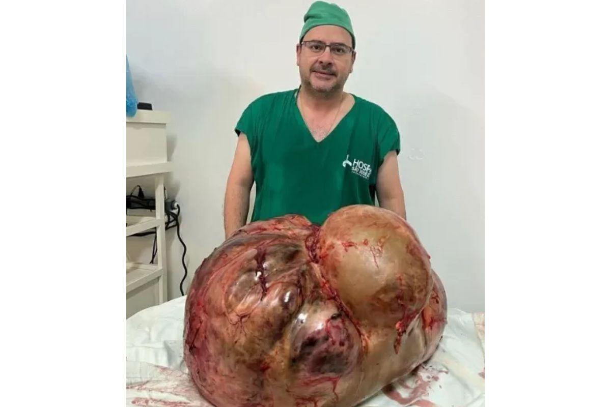 O médico contou que foi a primeira vez retirando um tumor deste tamanho