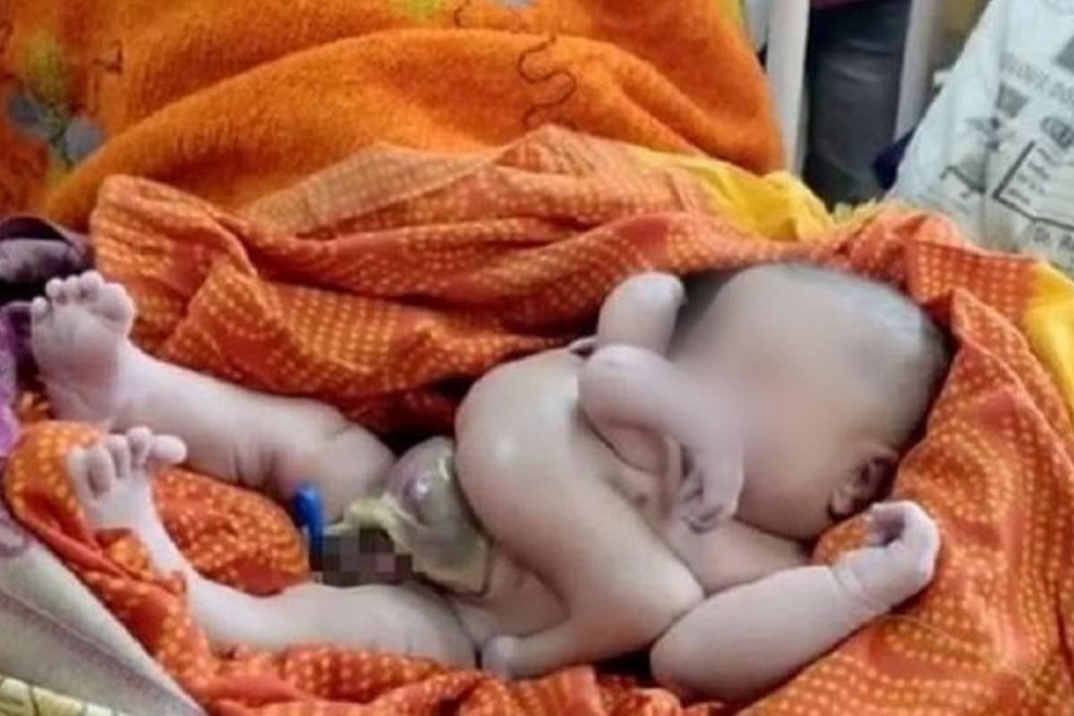 Muitos acreditam que o bebê é a encarnação de um deus hindu