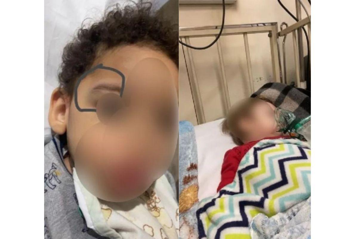 As crianças apareceram com hematomas e falta de ar após sair do berçário