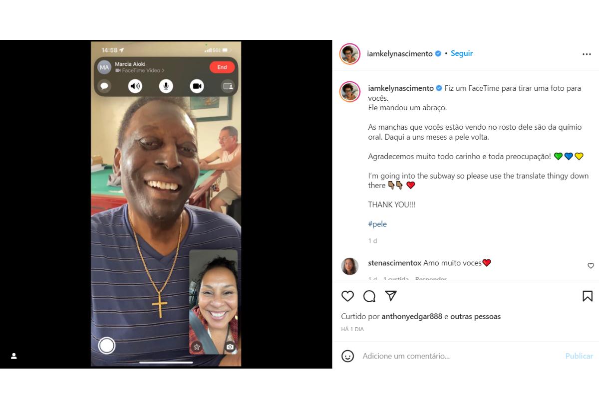Filha de Pelé tranquilizou os fãs
