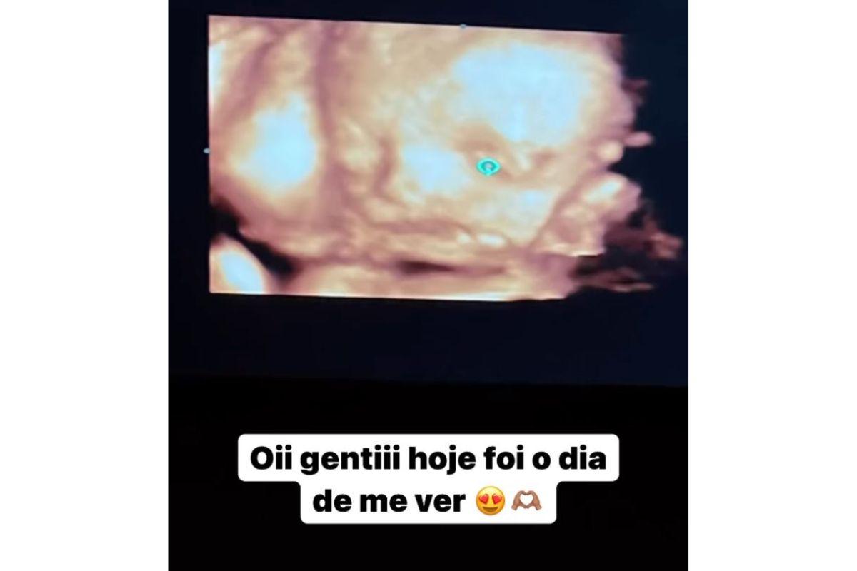 O ultrassom foi mostrado nos stories