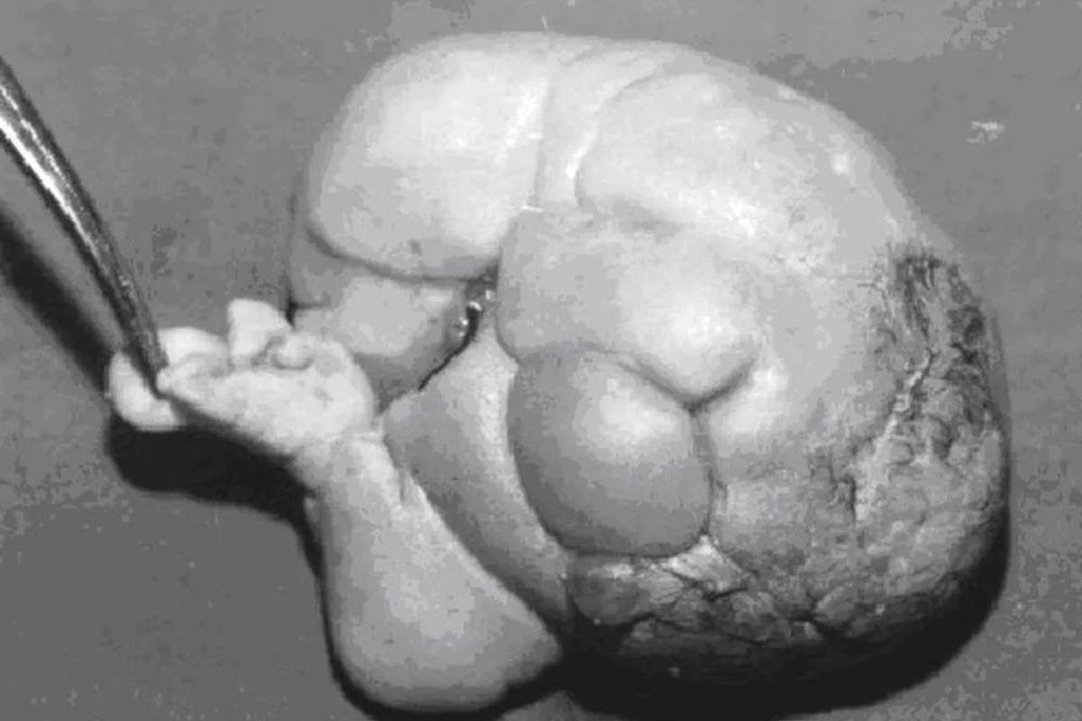 homem gravido sanju bhagat