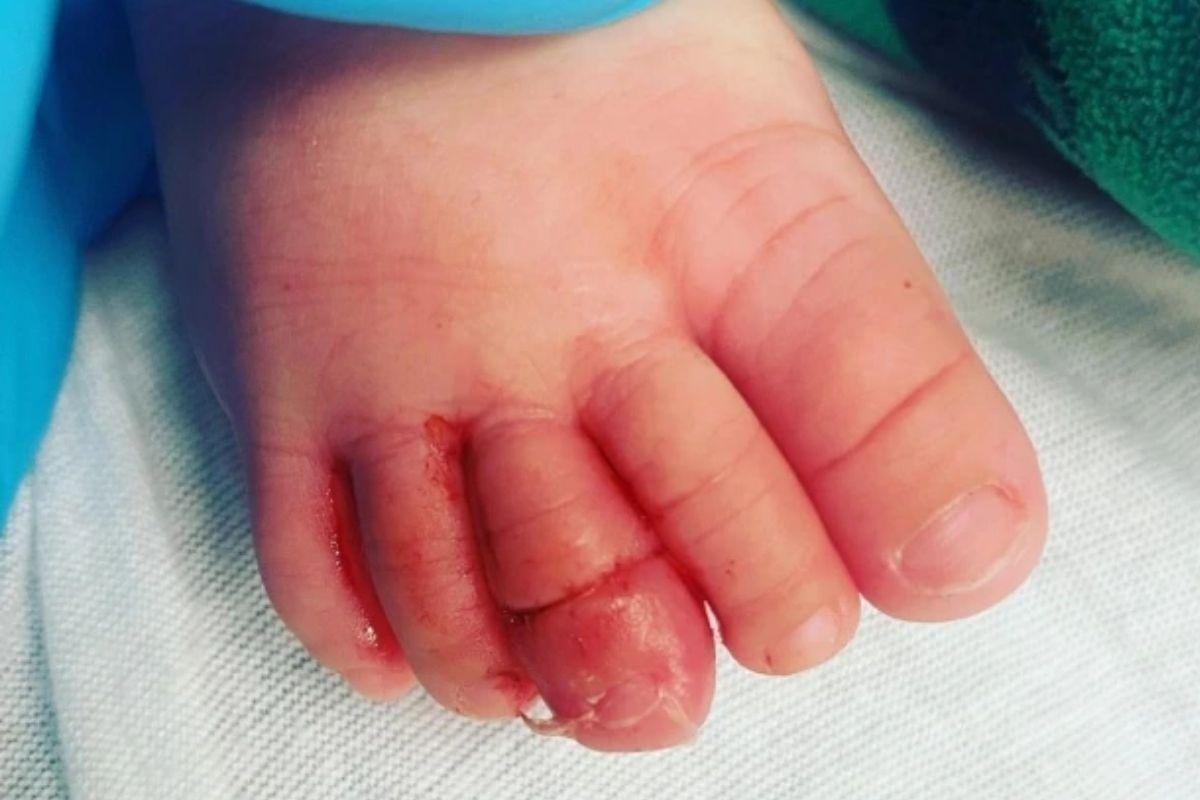 Nikki admitiu que a filha se machucou