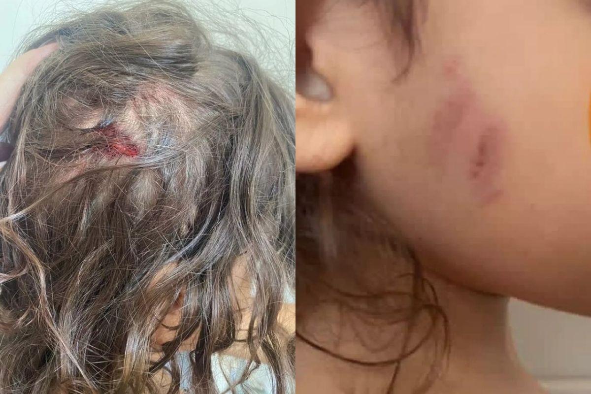 A criança sofreu um corte profundo na cabeça e tinha hematomas pelo corpo
