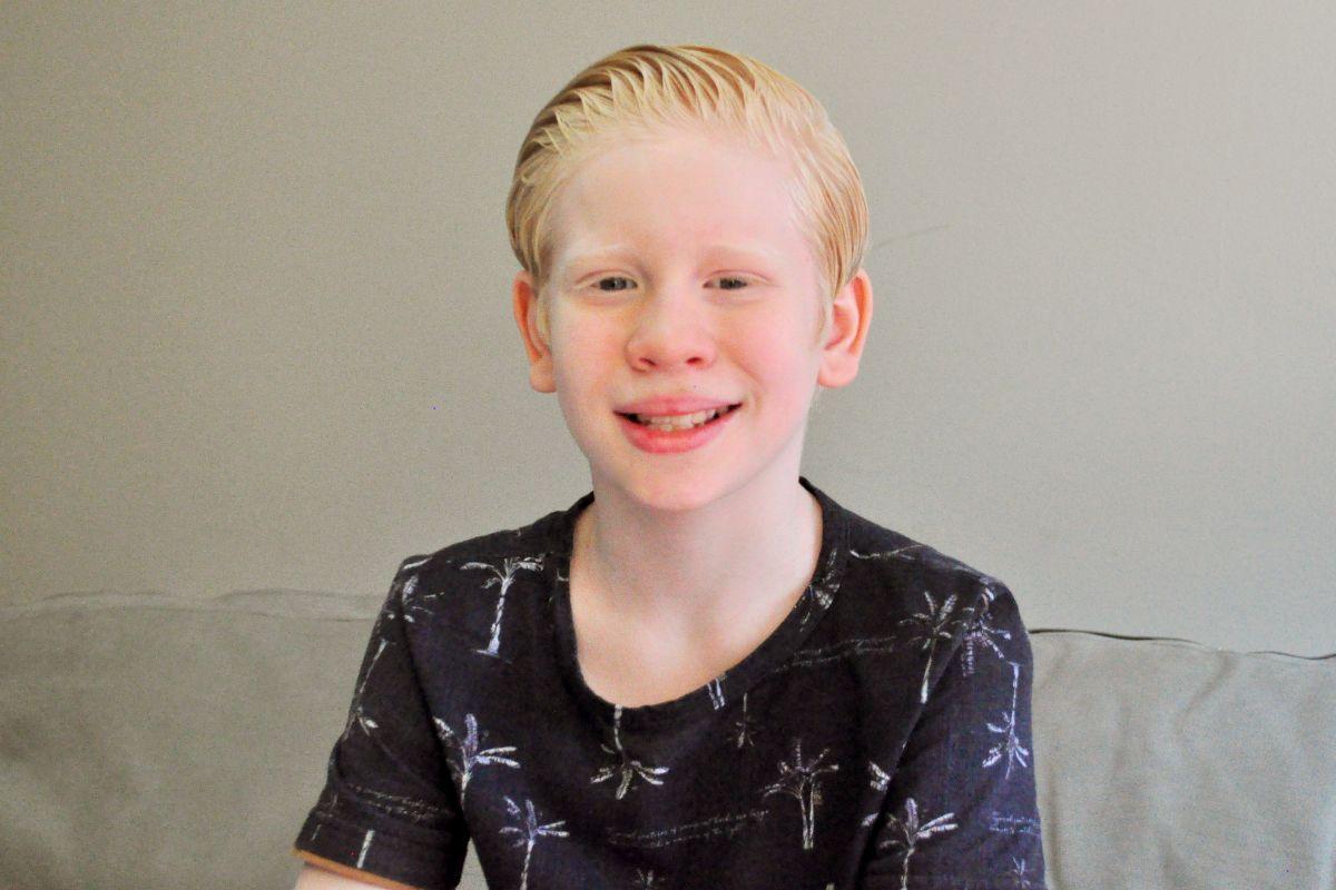 Felipe Melquiades, ator mirim Felipe Melquiades, família Felipe Melquiades, Felipe Melquiades albinismo, Cristian Terra e Paixão, Cristian novela albino, ator mirim albino