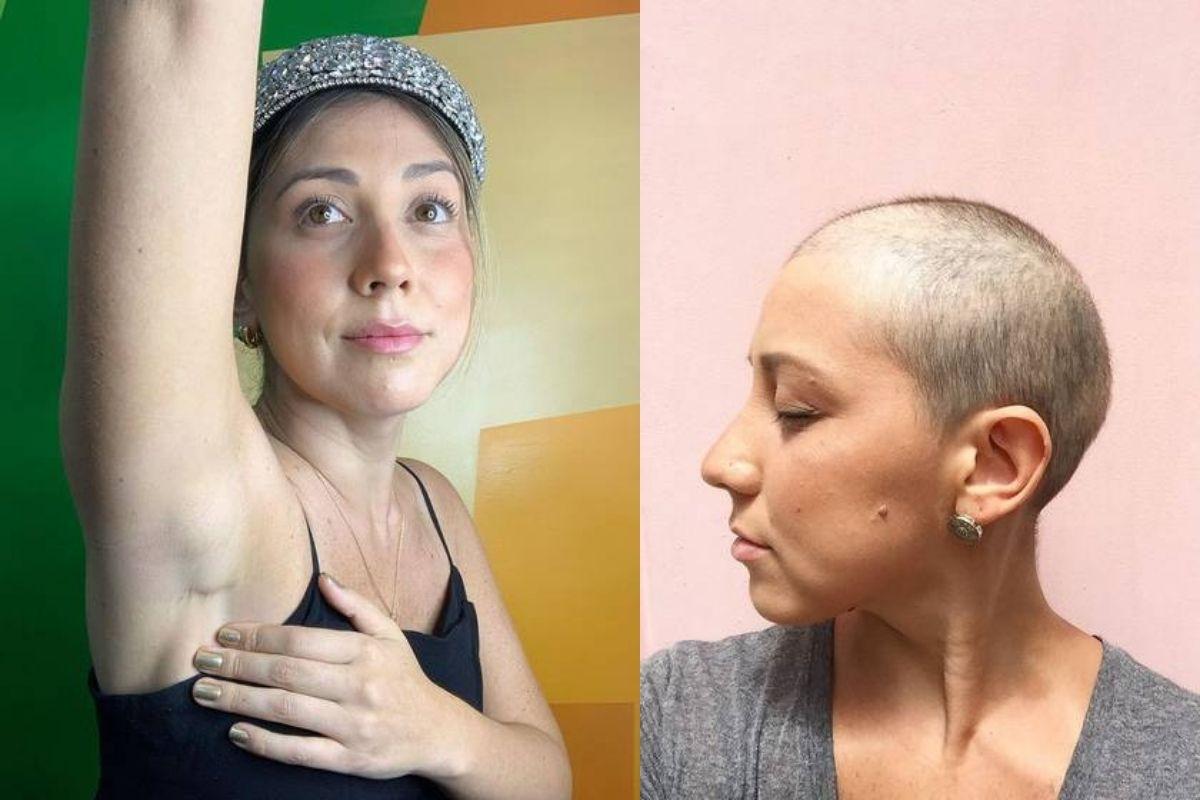 Linda precisou retirar pele e músculo das costas para reconstruir a mama