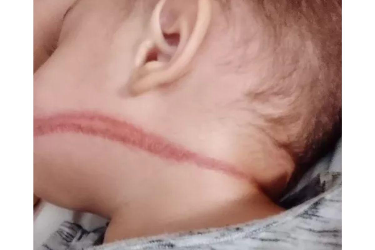 A família estava voltando da creche quando o acidente aconteceu