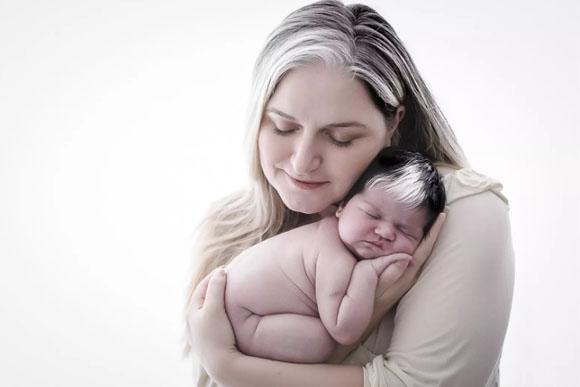 Mãe e bebê as duas tem piebaldismo (Foto: reprodução instagram)