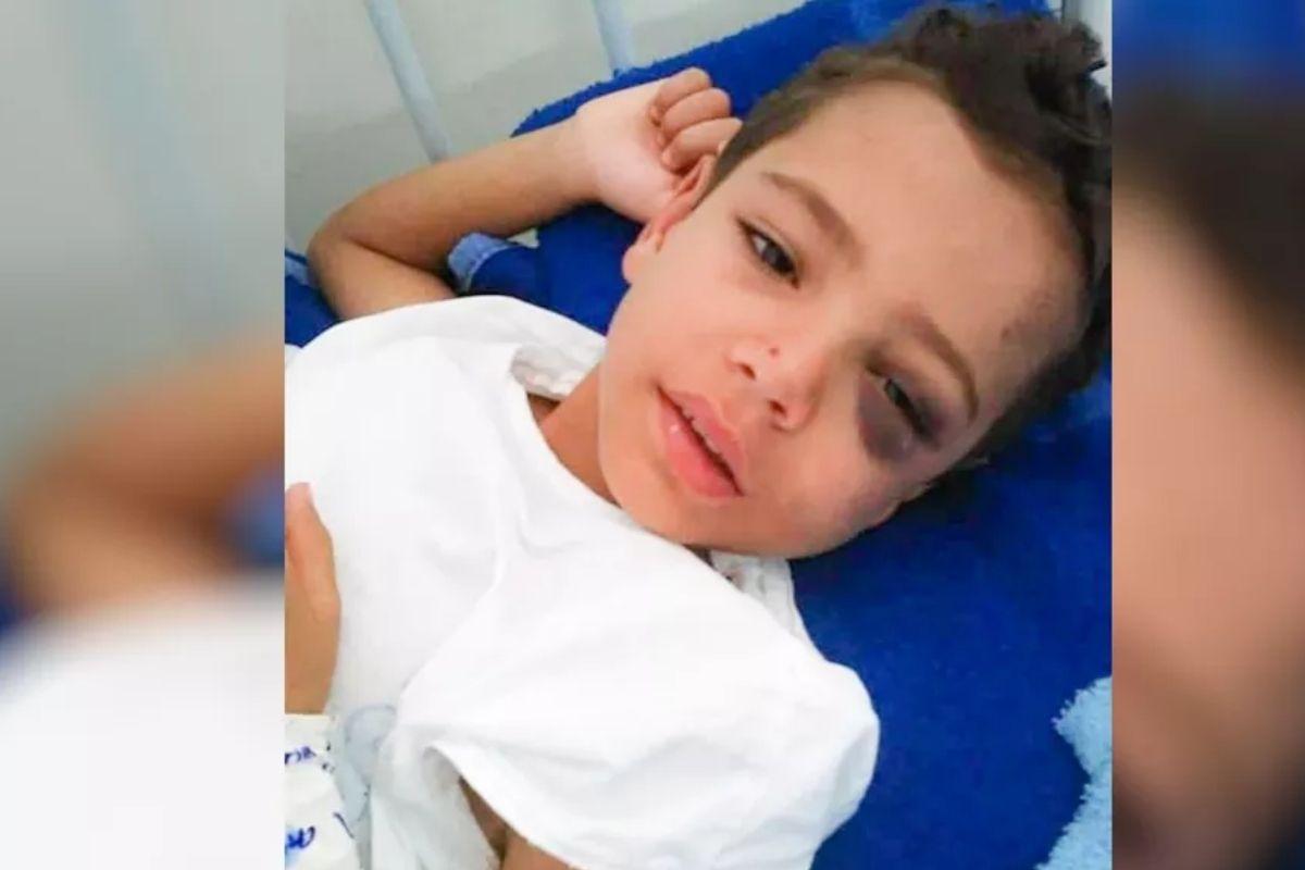 Ailton também tinha 8 anos quando caiu do toboágua