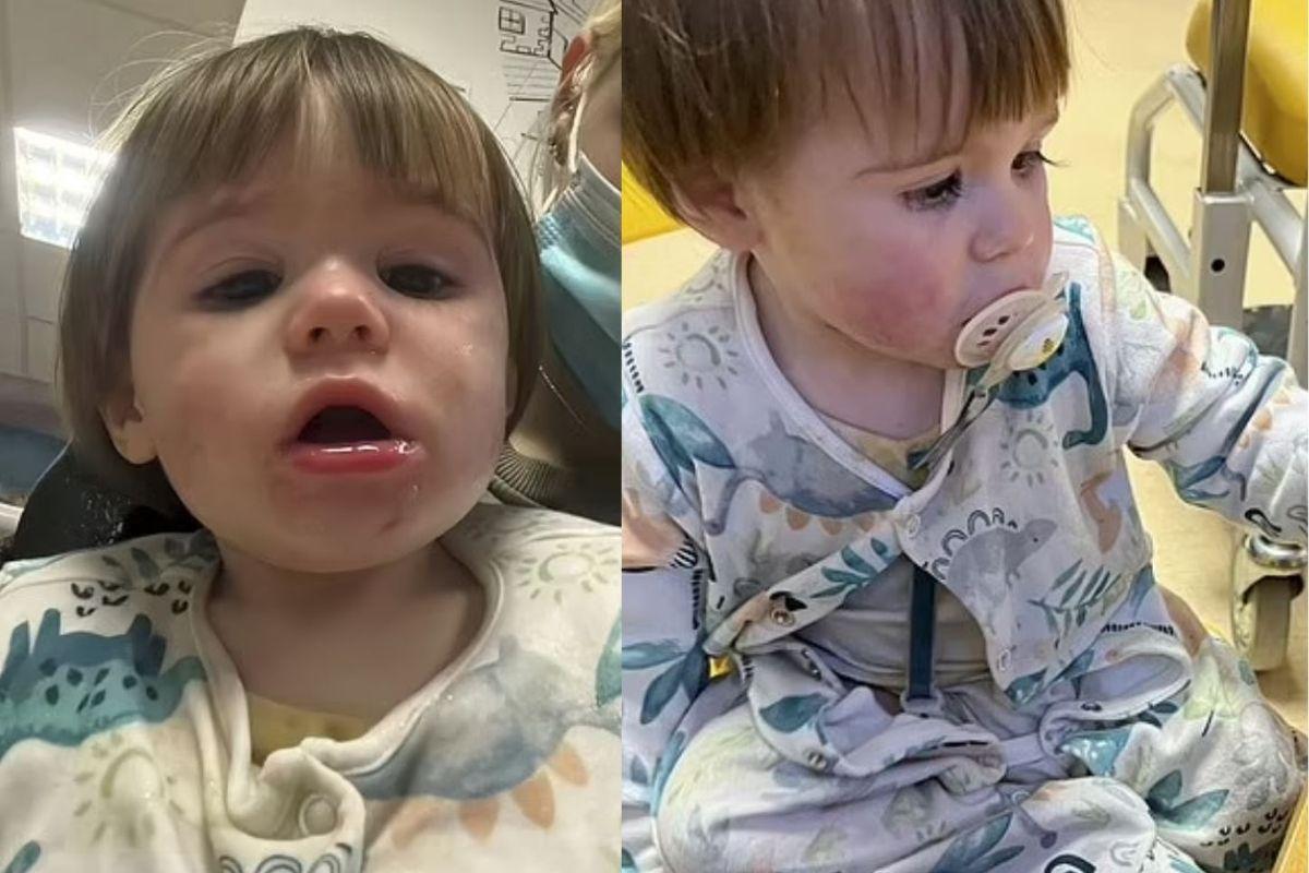 O bebê teve fortes reações com a ingestão da cápsula